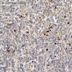 Anti-Cleaved-Caspase-3...