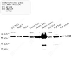 Anti-Serine/threonine-prote...
