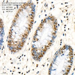 Anti-Serine/threonine-protein kinase 4/MST-1 Rabbit pAb