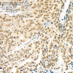 Anti-Serine/threonine-protein kinase 4/MST-1 Rabbit pAb