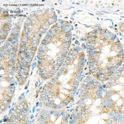 Anti-Carma 1/CARD11 Rabbit pAb
