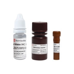 S-Vision IHC Kit (Poly-HRP Conjugated Goat Anti-Mouse and Rabbit lgG (H+L)
