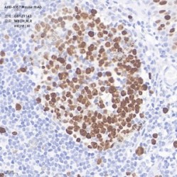 Anti-Ki67 Mouse mAb