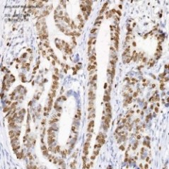 Anti-Ki67 Mouse mAb
