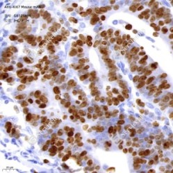 Anti-Ki67 Mouse mAb