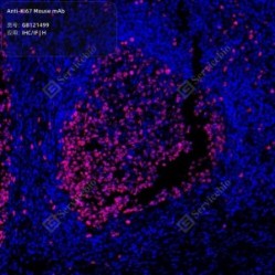 Anti-Ki67 Mouse mAb
