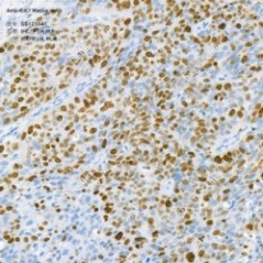 Anti-Ki67 Mouse mAb