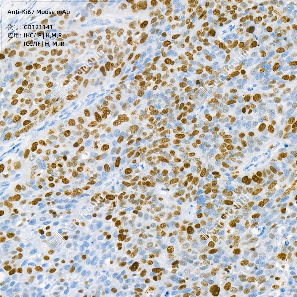Anti-Ki67 Mouse mAb