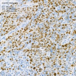 Anti-Ki67 Mouse mAb