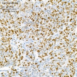 Anti-Ki67 Mouse mAb
