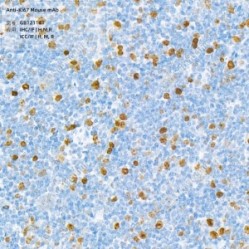 Anti-Ki67 Mouse mAb