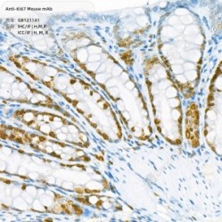 Anti-Ki67 Mouse mAb