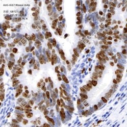 Anti-Ki67 Mouse mAb