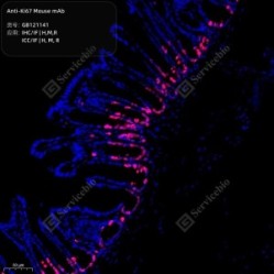 Anti-Ki67 Mouse mAb