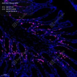 Anti-Ki67 Mouse mAb