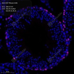 Anti-Ki67 Mouse mAb