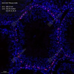 Anti-Ki67 Mouse mAb