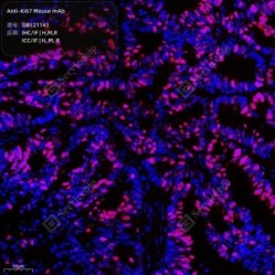 Anti-Ki67 Mouse mAb