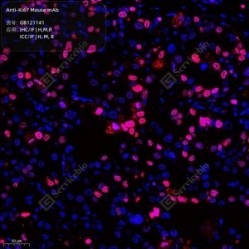 Anti-Ki67 Mouse mAb