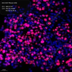 Anti-Ki67 Mouse mAb
