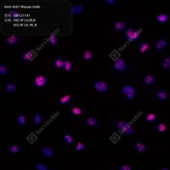Anti-Ki67 Mouse mAb