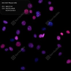 Anti-Ki67 Mouse mAb