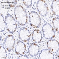 Anti-Ki67 Mouse mAb