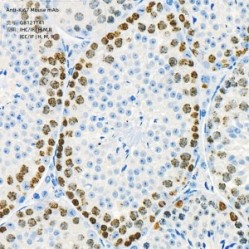 Anti-Ki67 Mouse mAb