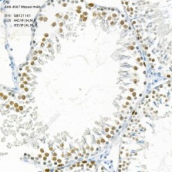 Anti-Ki67 Mouse mAb
