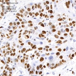 Anti-Ki67 Mouse mAb