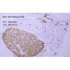 Anti-Ki67 Mouse mAb