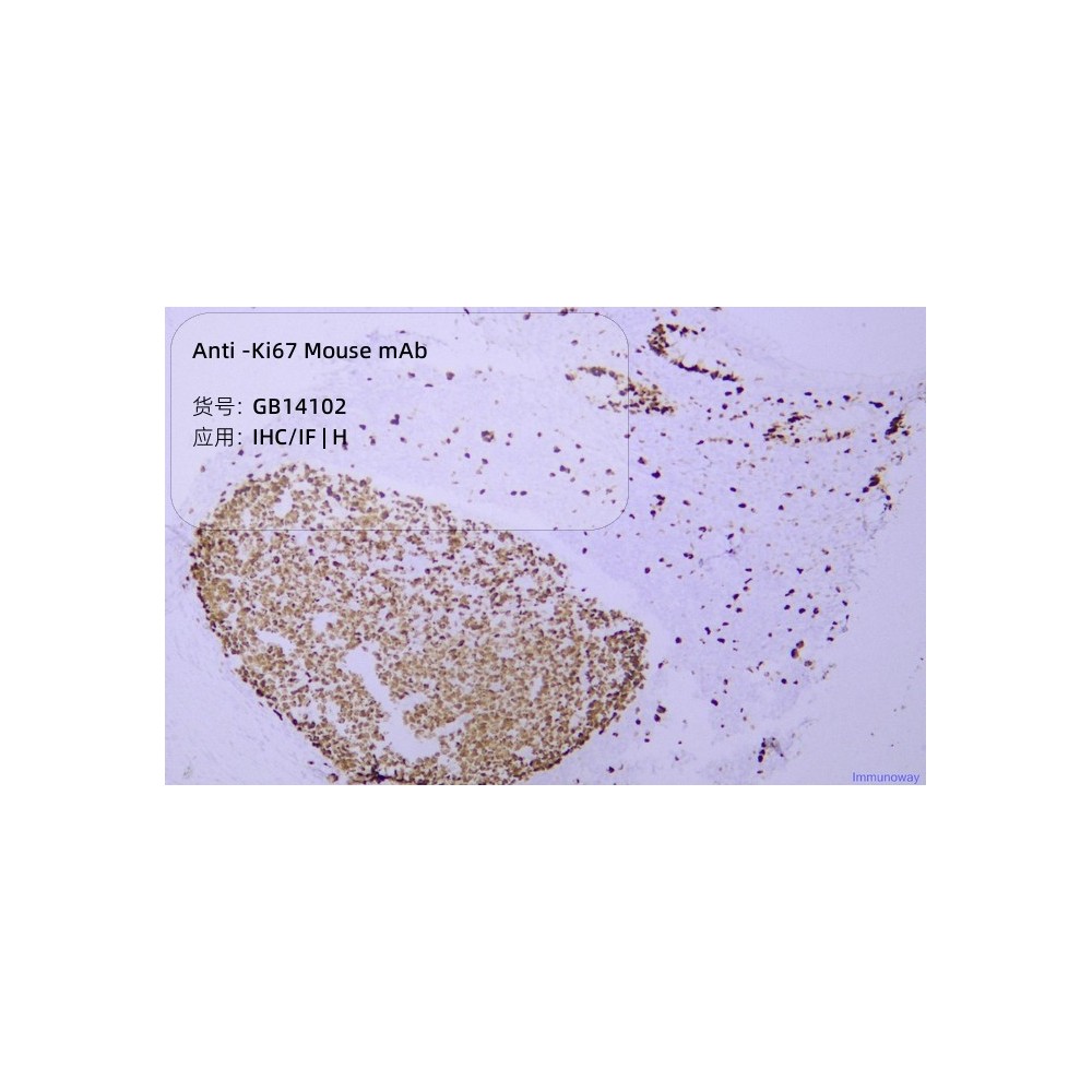 Anti-Ki67 Mouse mAb