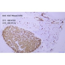 Anti-Ki67 Mouse mAb