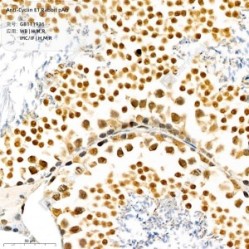 Anti-Cyclin E1 Rabbit pAb