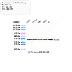 Recombinant Anti-Rad51 antibody (Mouse mAb)