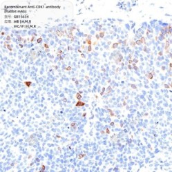 Recombinant Anti-CDK1 antibody (Rabbit mAb)