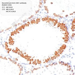 Recombinant Anti-CDK1 antibody (Rabbit mAb)