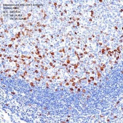 Recombinant Anti-CDK1 antibody (Rabbit mAb)