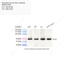 Recombinant Anti-PLK1 antibody (Rabbit mAb)