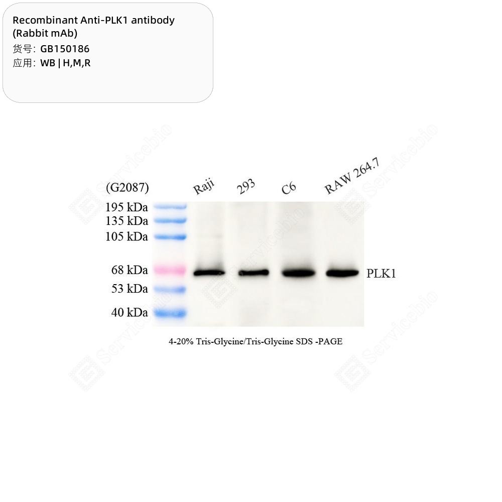 Recombinant Anti-PLK1 antibody (Rabbit mAb)