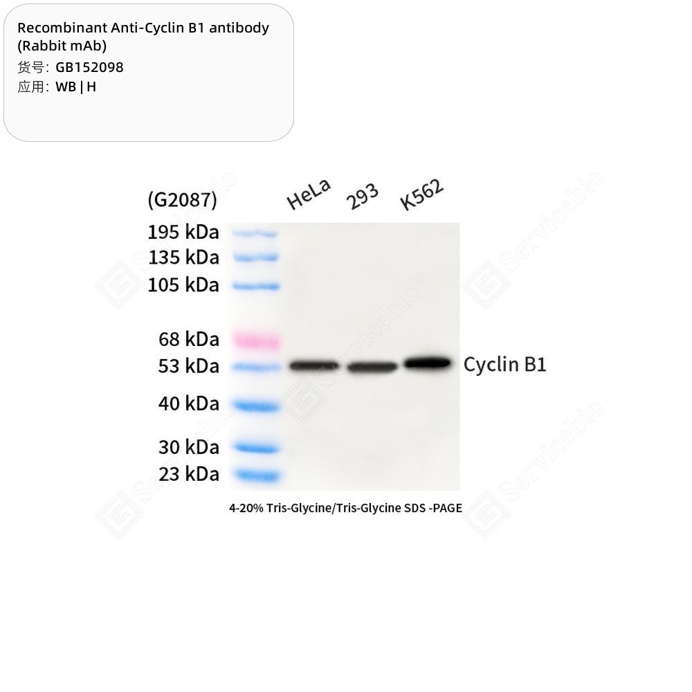 Recombinant Anti-Cyclin B1 antibody (Rabbit mAb)