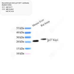 Recombinant Anti-p27 KIP 1 antibody (Rabbit mAb)