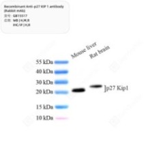 Recombinant Anti-p27 KIP 1...