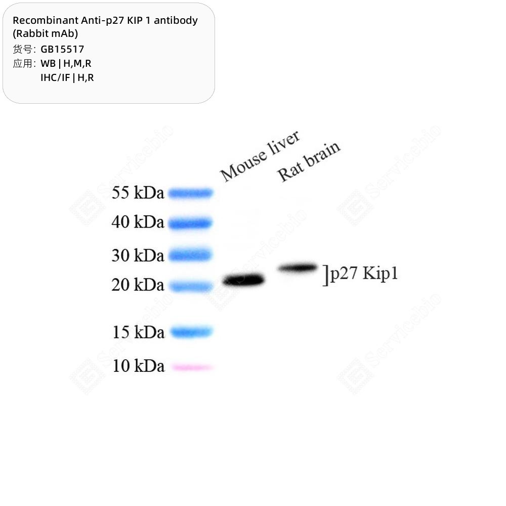 Recombinant Anti-p27 KIP 1 antibody (Rabbit mAb)