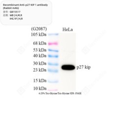 Recombinant Anti-p27 KIP 1 antibody (Rabbit mAb)