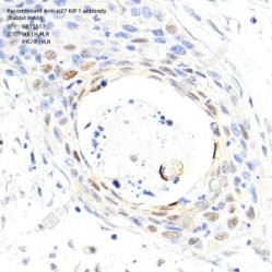 Recombinant Anti-p27 KIP 1 antibody (Rabbit mAb)