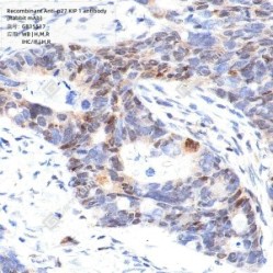 Recombinant Anti-p27 KIP 1 antibody (Rabbit mAb)