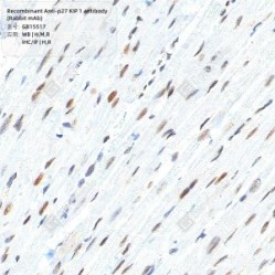 Recombinant Anti-p27 KIP 1 antibody (Rabbit mAb)