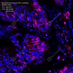 Recombinant Anti-p27 KIP 1 antibody (Rabbit mAb)