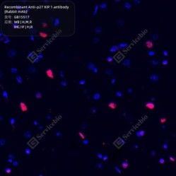 Recombinant Anti-p27 KIP 1 antibody (Rabbit mAb)